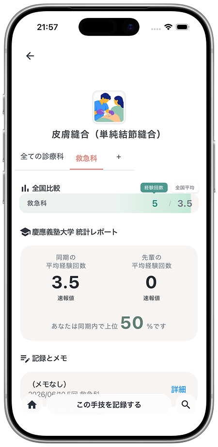 polimoアプリの手技比較・統計画面